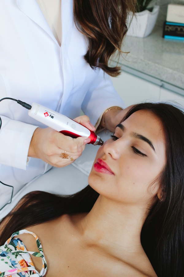 Microneedling – hero